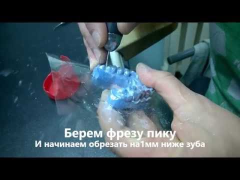 Видео: изготовление каппы для отбеливания