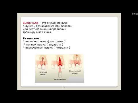 Видео: Кариесология 2.4. Травматические повреждения зубов