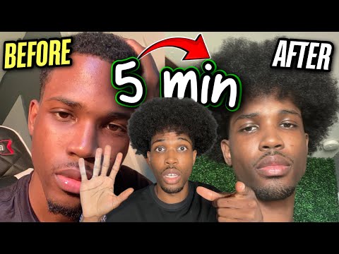 Видео: Как отрастить волосы быстрее и длиннее: 5-минутный ежедневный метод для максимального роста волос