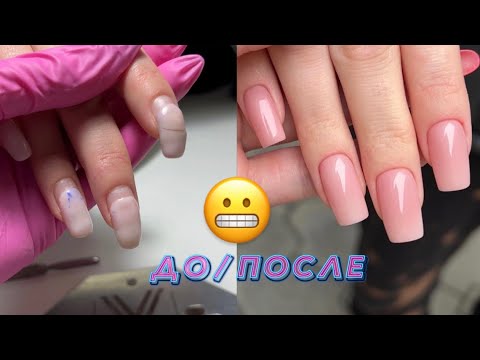 Видео: ЧТО ЗА 😱 ДО/ПОСЛЕ | КОРРЕКЦИЯ ГЕЛЕМ+ВЕРХНИЕ ФОРМЫ #маникюр #гель #наращиваниеногтей #верхниеформы