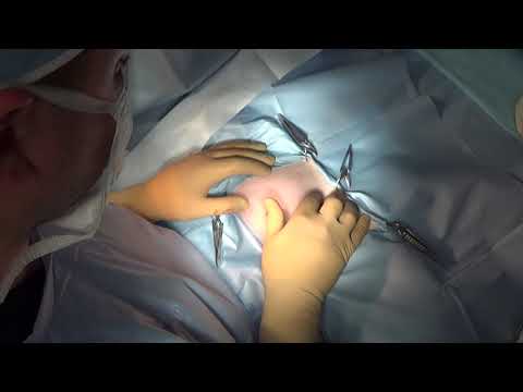 Видео: Хирургическое лечение хилоторакса у кошки