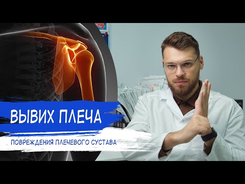 Видео: ВЫВИХ ПЛЕЧА | Повреждения плечевого сустава