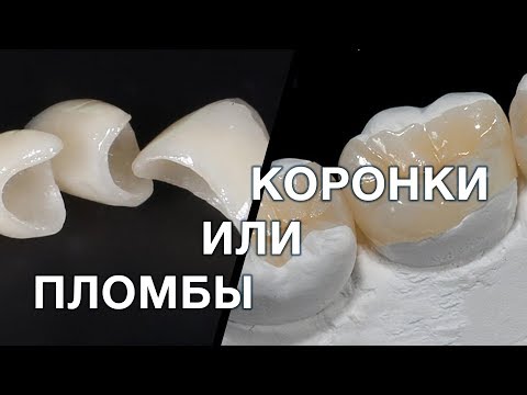 Видео: Пломба или коронка? Что лучше выбрать и в какой ситуации ?