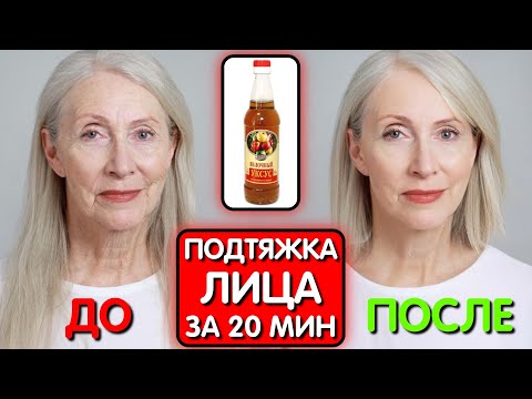 Видео: УКСУС давно ЗАМЕНИЛ БОТОКС ! Эта маска СТИРАЕТ МОРЩИНЫ и ПЯТНА Эффект виден сразу !