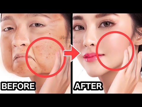 Видео: 12 МИНУТ✨ BOOST COLLAGEN + ПОДТЯЖКА ЛИЦА✨ | УВЕЛИЧИТЬ СИЯНИЕ КОЖИ, ПОДТЯНУТЬ КОЖУ, ПРОТИВ СТАРЕНИЯ