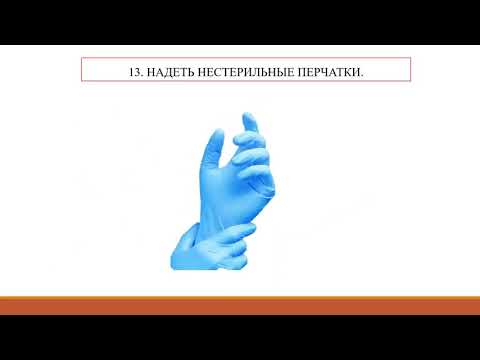 Видео: Уход за постоянным мочевым катетером Фолея (у мужчин)