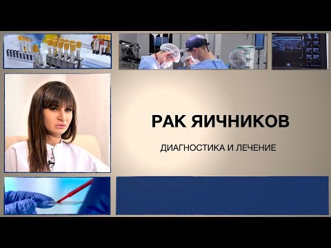 Видео: Рак яичников: лечение и диагностика.