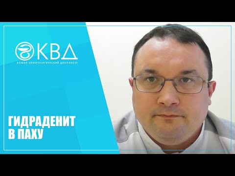 Видео: 1159  Гидраденит в паху