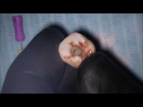 Видео: Работа в резких изгибах файлами Sani blu storm.