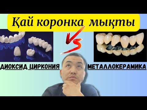 Видео: Металлокерамика и диоксид циркония. Қайсы коронка сапасы керемет! Стоматология Каронка тис