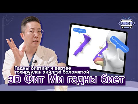 Видео: ГРАНД ГОО САЙХНЫ ЭМНЭЛЭГ - Хамрын мэс засал 3D Фит Ми Гадны Биет