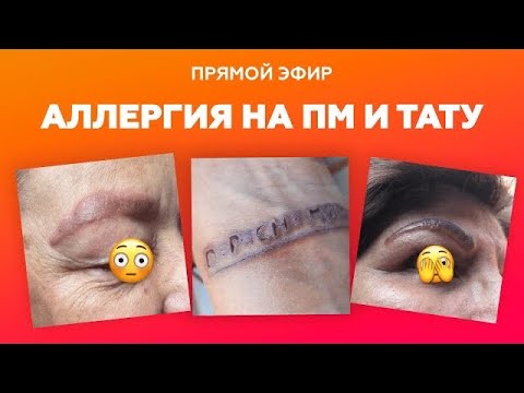 Видео: Запись эфира "Аллергия на ПМ и тату"