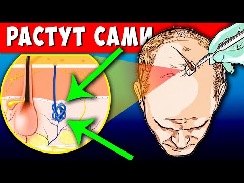 Видео: Даже из Лысины полезут Волосы, если следовать Простым правилам.. Отрастить Шикарную Шевелюру легко!