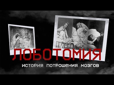 Видео: ЛОБОТОМИЯ - История варварского потрошения мозгов