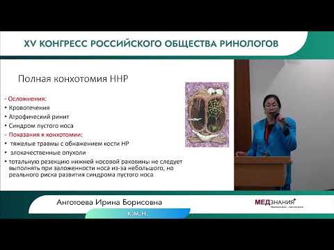 Видео: 30.06.23  ХИРУРГИЯ НОСОВЫХ РАКОВИН