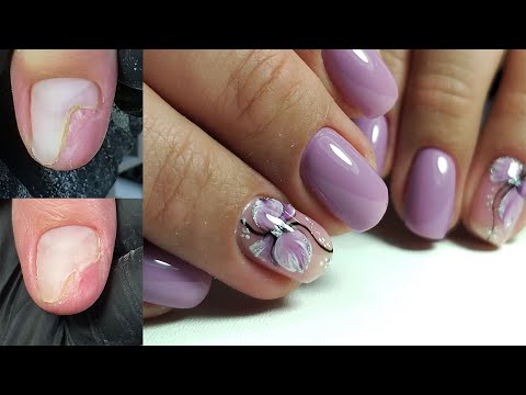 Видео: ❤ СЛЕДИМ за ДИНАМИКОЙ ❤ травма ногтя ❤ ВЕСЕННИЙ дизайн ❤ЦВЕТЫ на ногтях ПОШАГОВО ❤