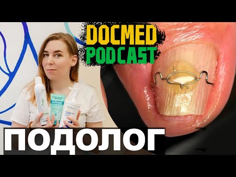 Видео: ПОДОЛОГ о грибке ногтей, вросших ногтях и терещинах на пятках