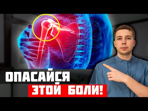 Видео: Синдром замороженного плеча! Как лечить? БОЛЬ В ПЛЕЧЕ!