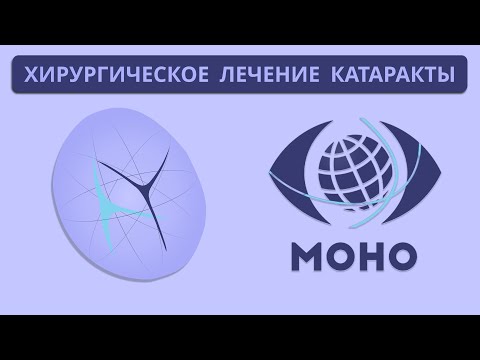 Видео: Лечение катаракты. 1-ое заседание МОНО