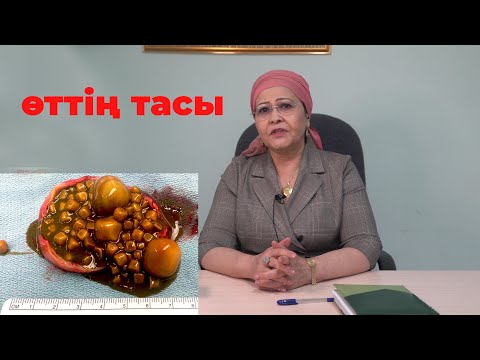 Видео: Өттің ТАСЫ | Өттегі тасты қалай түсіруге болады? | Өт тасын түсіру жолдары