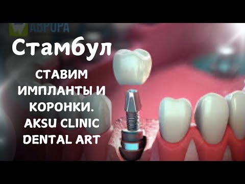 Видео: 🇹🇷ISTANBUL ‼️ИМПЛАНТЫ И КОРОНКИ. ЛЕТИМ ИЗ АМЕРИКИ ‼️ОБЗОР КЛИНИКИ, ЦЕНЫ. AKSU CLINIC DENTAL ART