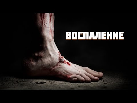 Видео: Воспаление // Патфизиология (3 тема)