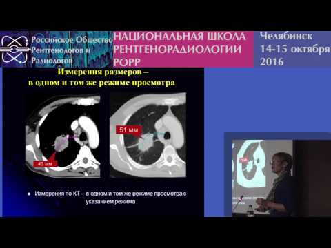 Видео: О.Н. Чернова - Критерии RECIST 1.1 в диагностике и лечении рака лёгкого