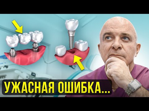 Видео: ПОСЛЕДСТВИЯ НЕИЗБЕЖНЫ! ИМПЛАНТ или МОСТ - что выбрать, чтобы НЕ ПОЖАЛЕТЬ?