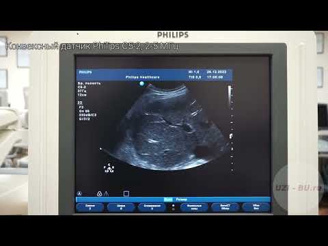Видео: Philips HD11 XE обзор ультразвукового сканера