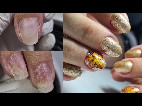 Видео: ❤ РЕМОНТ КАЖДОГО ногтя ❤ НОВИНКА STALEKS ❤ СЛОЖНЫЕ ногти ❤ ОСЕННИЙ маникюр ❤ ВЫСОКИЕ точки ВРОСТА ❤
