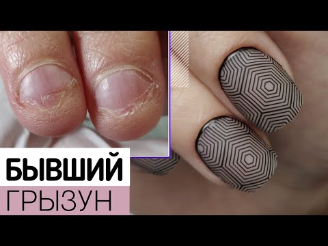 Видео: 🥳 Исцеление грызуна: 2 КОРРЕКЦИИ. Маникюр ПРЕОБРАЖЕНИЕ сгрызеных ногтей. Как перестать грызть ногти