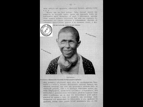 Видео: Психозы вырождения:идиотия/тупоумие/нравственное помешательство. Проф.П.И. Ковалевский. СПб, 1905 г.