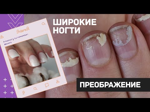 Видео: ШИРОКИЕ ногти: преображение. Наращивание ногтей гелем. Как подобрать форму ногтей. Светлый маникюр