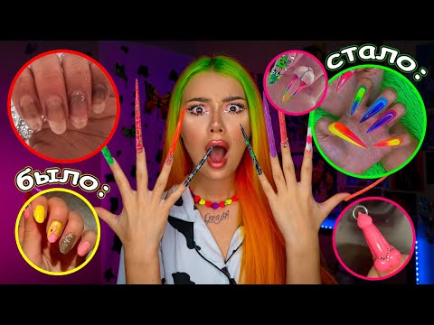 Видео: ИСТОРИЯ моих НОГТЕЙ *спилили до МЯСА, ГРИБОК*