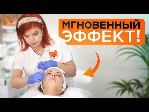 Видео: НЕ ДЕЛАЙ химический ПИЛИНГ лица, пока не ПОСМОТРИШЬ ЭТО видео!