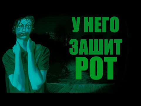Видео: ОН НЕ МОЖЕТ РАЗГОВАРИВАТЬ!