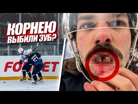 Видео: КОРНЕЮ ВЫБИЛИ ЗУБ? Хоккей на 50.000 рублей