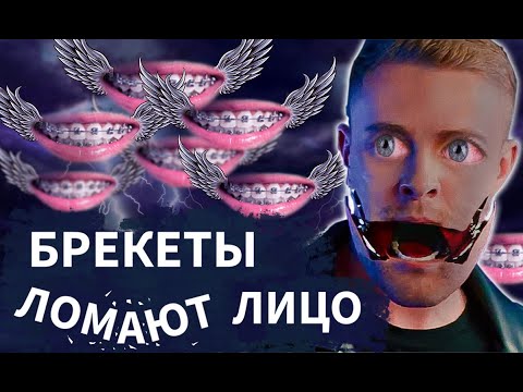 Видео: Брекеты ломают лицо. Запись прямого эфира