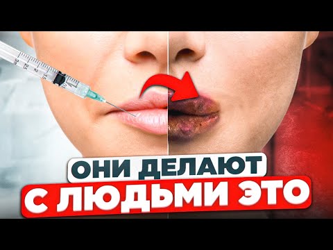 Видео: Как вас обманывают косметологи? Рынок черной косметологии | Косметология в Москве