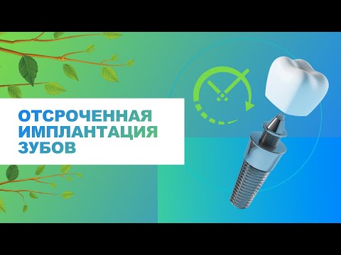 Видео: ⚡​ Отсроченная имплантация зубов