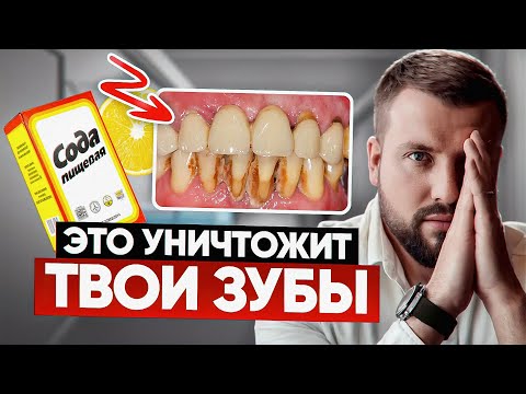 Видео: Зубная Катастрофа: Что Советуeт Интернет? Народные мифы
