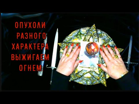 Видео: ОПУХОЛИ РАЗНОГО ХАРАКТЕРА ВЫЖИГАЕМ ОГНЕМ. КАССАНДРА & ФРЕЙЯ. МАГИЯ ОБРЯДЫ РИТУАЛЫ ГАДАНИЯ.