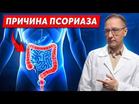 Видео: Как появляется псориаз? ПРИЧИНА дырявый кишечник