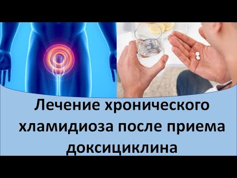 Видео: Лечение хронического хламидиоза после приема доксициклина