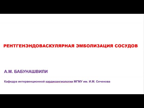 Видео: Рентгенэндоваскулярная эмболизация артерий (Профессор А.М. Бабунашвили)