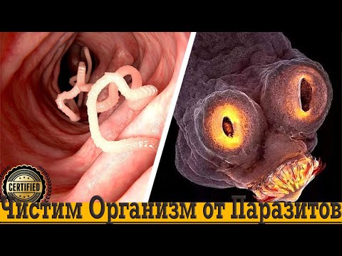 Видео: Как быстро очистить организм от паразитов!