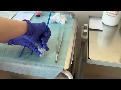 Видео: Взяття матеріалу для цитологічного дослідження