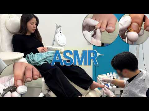 Видео: 【ASMR】 Странно приятное очищение ногтей на ногах🦶✨Освежает!｜Мозоли на ногах