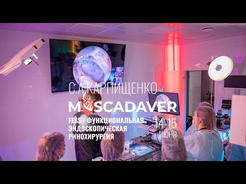 Видео: fess - функциональная эндоскопическая ринохирургия