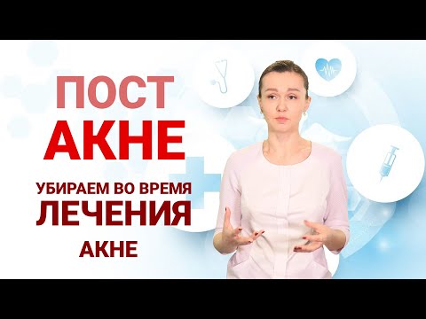 Видео: Постакне -  убираем во время лечения акне